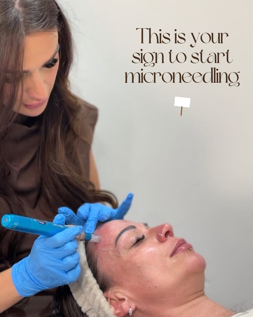 Microneedling treatment being carried out in clinic at The Nurse Collective