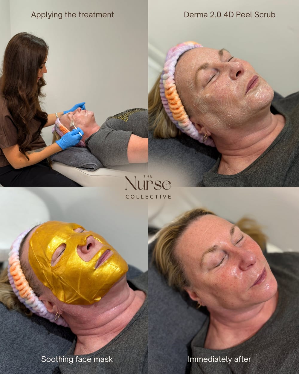 Derma 2.0 4D Peel Scrub facial shown at every stage, from application to soothing mask to immediately after